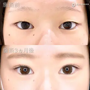 症例