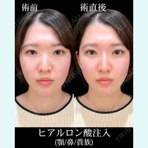 HAAB×DREAM BEAUTY CLINIC 東京本院 佐野 圭医師の症例