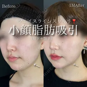 症例
