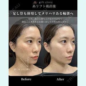 gift clinic 能登谷 翔医師の症例