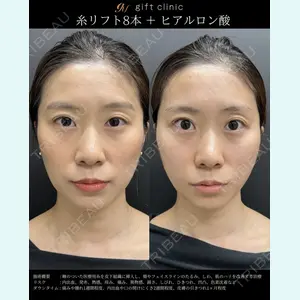gift clinic 能登谷 翔医師の症例