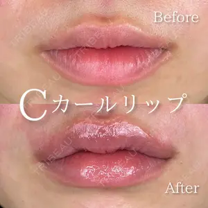 症例