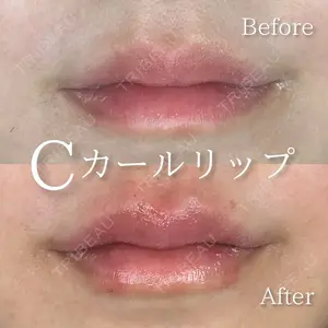 症例