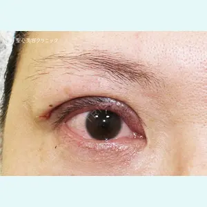 聖心美容クリニック 札幌院 前多 一彦医師の症例