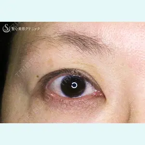 症例