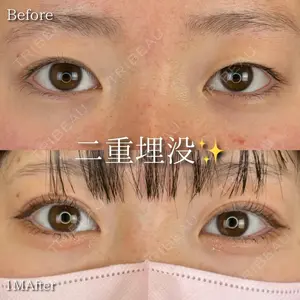 症例