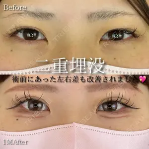 症例