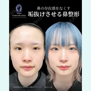 症例