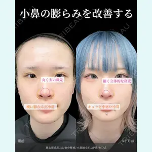 症例