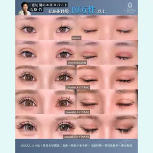 症例