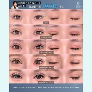 症例