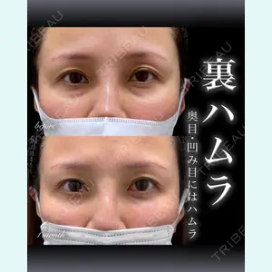 EMMO FACE CLINIC 大宮院 百瀬 直也医師の症例