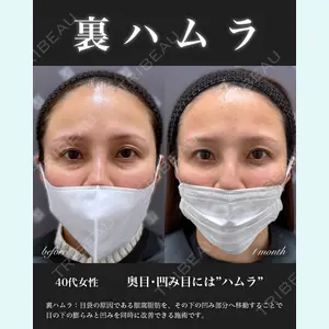 EMMO FACE CLINIC 大宮院 百瀬 直也医師の症例