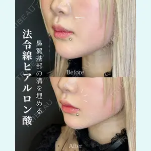 症例