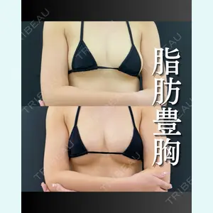 症例