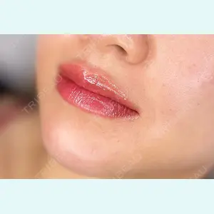 SUBCLi（＆ABCクリニック）の症例