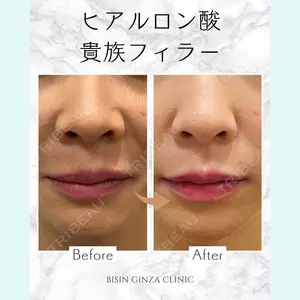 BISIN GINZA CLINICの症例