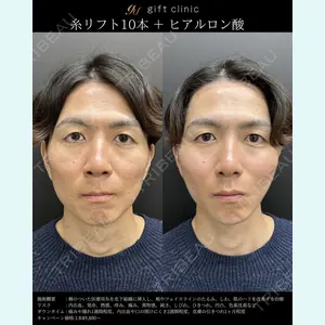 gift clinic 能登谷 翔医師の症例