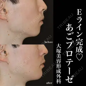 大塚美容形成外科 銀座本院 石井秀典医師の症例
