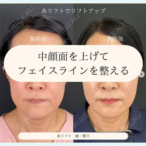 自由が丘ウェルエイジングビューティークリニックの症例