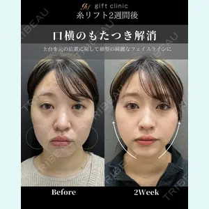 gift clinic 能登谷 翔医師の症例