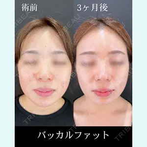 HAAB×DREAM BEAUTY CLINIC 大阪梅田院 柏木 太雅医師の症例