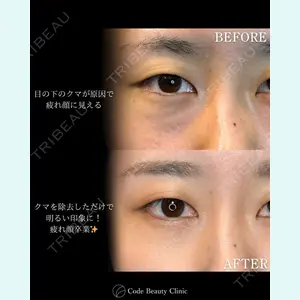 Code Beauty Clinic 名古屋院 橋本 祥平医師の症例
