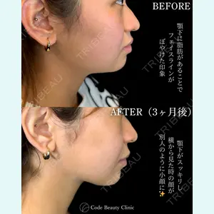 Code Beauty Clinic 名古屋院 橋本 祥平医師の症例
