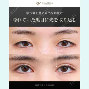 症例