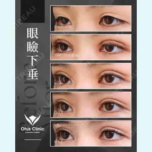 症例