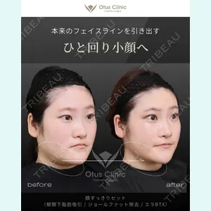 症例
