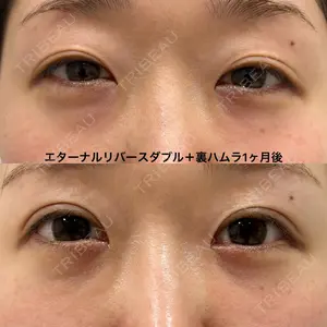エターナル美容クリニック 久門田 詳医師の症例