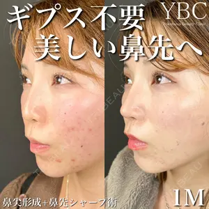 YBC横浜美容外科 大宮院 磯村 亮輔医師の症例