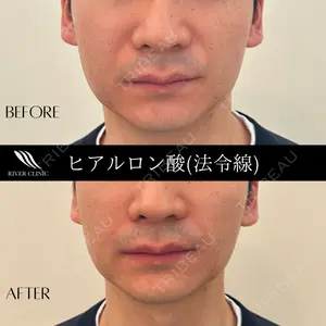 症例