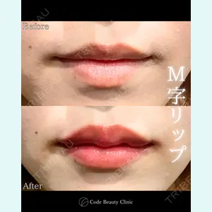 Code Beauty Clinic 名古屋院 橋本 祥平医師の症例