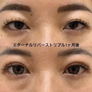 エターナル美容クリニック 久門田 詳医師の症例