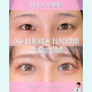 eクリニック 金沢本院 島田 良浩医師の症例