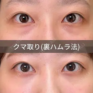 症例