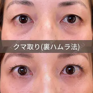 症例