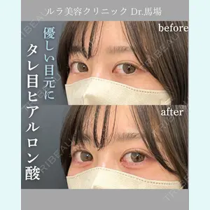 症例