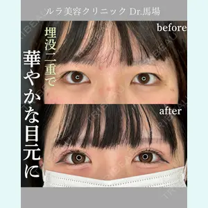 症例