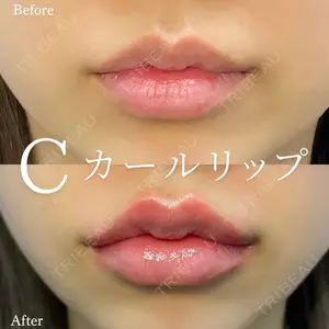 症例