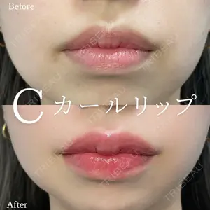 症例