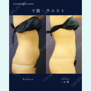 ガーデンクリニック 船橋院の症例