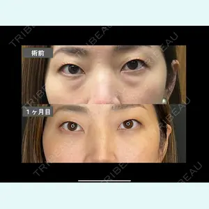 CHARIS BEAUTY CLINIC 木畑智哲医師の症例