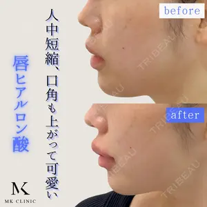 MKクリニック 銀座院の症例