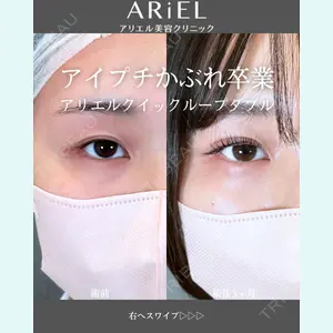 アリエル美容クリニック 郡山院 安齋 誠基医師の症例
