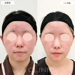 A CLINIC（エークリニック） 仙台院 伊藤 瑠桂医師の症例