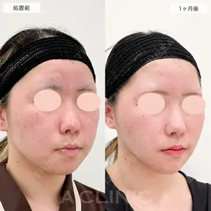 A CLINIC（エークリニック） 仙台院 伊藤 瑠桂医師の症例