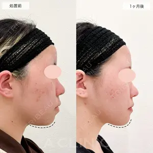 A CLINIC（エークリニック） 仙台院 伊藤 瑠桂医師の症例
